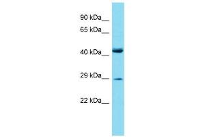 Host:  Rabbit  Target Name:  Prrx2  Sample Type:  Mouse Small Intestine lysates  Antibody Dilution:  1.