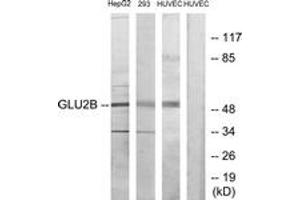 Western blot analysis of extracts from HepG2/293/HuvEC cells, using GLU2B Antibody. (PRKCSH Antikörper  (AA 81-130))