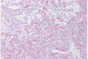 Anti-MCM3 antibody IHC staining of human thymus. (MCM3 Antikörper  (AA 726-775))