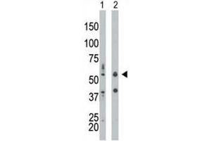 PKR antibody used in western blot to detect PRKR/PKR in mouse liver tissue lysate (Lane 1) and HepG2 cell lysate (2). (EIF2AK2 Antikörper  (AA 11-42))