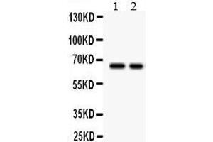 Lane 2: COLO320 Whole Cell Lysate at 40ug Predicted bind size: 65KD Observed bind size: 65KD