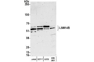 anti-LSM14B, SCD6 Homolog B (LSM14B) (AA 335-385) antibody