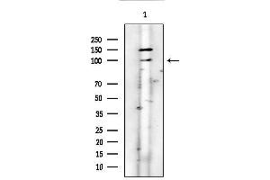 anti-Integrin, alpha 3 (ITGA3) (Internal Region) antibody