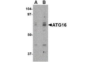 Western Blotting (WB) image for anti-ATG16 Autophagy Related 16-Like 1 (ATG16L1) (Internal Region) antibody (ABIN2477528) (ATG16L1 Antikörper  (Internal Region))