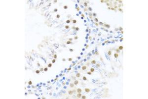 Immunohistochemistry of paraffin-embedded rat testis using DDX46 antibody  at dilution of 1:100 (40x lens). (DDX46 Antikörper  (AA 682-1031))