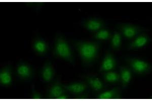 Immunofluorescence analysis of MCF7 cells using RORA Polyclonal Antibody (RORA Antikörper)