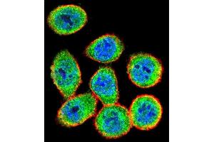 Confocal immunofluorescent analysis of IKK beta Antibody (ABIN1882097 and ABIN2842182) with Hela cell followed by Alexa Fluor 488-conjugated goat anti-rabbit lgG (green). (IKBKB Antikörper)