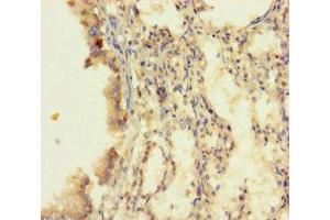 Immunohistochemistry of paraffin-embedded human lung tissue using ABIN7173528 at dilution of 1:100 (DUS4L Antikörper  (AA 1-196))