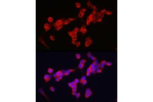 Immunofluorescence analysis of SH-SY5Y cells using KIF5A Rabbit pAb (ABIN1680589, ABIN3017664, ABIN3017665 and ABIN6220202) at dilution of 1:250 (40x lens). (KIF5A Antikörper  (AA 933-1032))