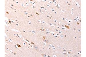 The image on the left is immunohistochemistry of paraffin-embedded Human brain tissue using ABIN7192139(RalA Antibody) at dilution 1/20, on the right is treated with synthetic peptide. (rala Antikörper)