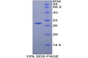 SDS-PAGE analysis of Rat B-Cell CLL/Lymphoma 3 Protein. (BCL3 Protein)
