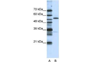 WB Suggested Anti-ZNF655 Antibody Titration:  1. (ZNF655 Antikörper  (N-Term))