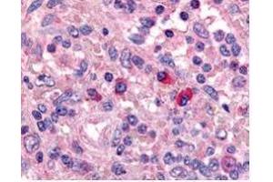 Affinity Purified anti-Artemis antibody was used at a 1:1000 dilution to detect Artemis by immunohistochemistry in human spleen. (DCLRE1C Antikörper  (AA 482-495))