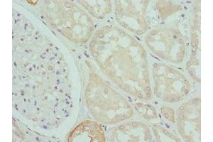 Immunohistochemistry of paraffin-embedded human kidney tissue using ABIN7146779 at dilution of 1:100 (CPN1 Antikörper  (AA 209-458))