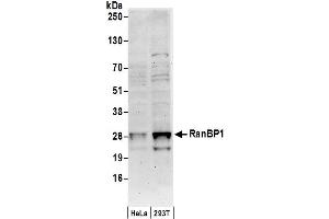 Western Blotting (WB) image for anti-RAN Binding Protein 1 (RANBP1) (C-Term) antibody (ABIN7451594)