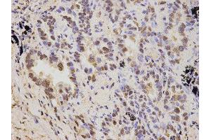 Immunohistochemistry (IHC) image for anti-Proteasome (Prosome, Macropain) 26S Subunit, Non-ATPase, 2 (PSMD2) antibody (ABIN1874389) (PSMD2 Antikörper)
