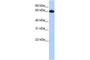 Western Blotting (WB) image for anti-Small Nuclear Ribonucleoprotein 70kDa (U1) (SNRNP70) antibody (ABIN2462137) (SNRNP70 Antikörper)