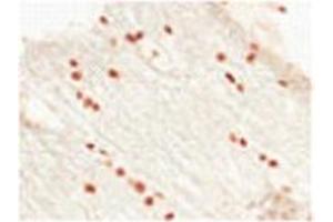 Immunohistochemistry (IHC) image for anti-Oligodendrocyte Lineage Transcription Factor 2 (OLIG2) (C-Term) antibody (ABIN2777566)