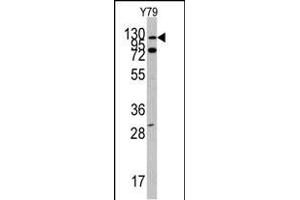 Western blot analysis of ABL1 Antibody (N-term ) (ABIN392079 and ABIN2841839) in Y79 cell line lysates (35 μg/lane). (ABL1 Antikörper  (N-Term))
