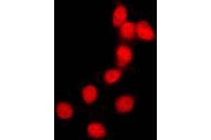 Immunofluorescent analysis of Histone H2B staining in HeLa cells. (Histone H2B Antikörper  (N-Term))
