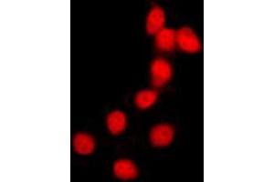Immunofluorescent analysis of Histone H2B staining in HeLa cells.