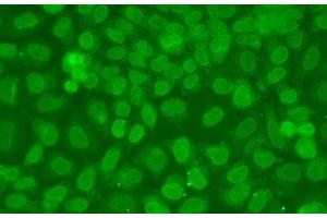 Immunofluorescence analysis of A549 cells using TARBP2 Polyclonal Antibody (TARBP2 Antikörper)