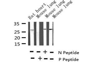 Western blot analysis of Phospho-p27 Kip1 (Ser10) expression in various lysates (CDKN1B Antikörper  (pSer10))