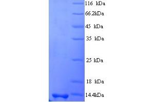 SDS-PAGE (SDS) image for Stimulator of Chondrogenesis 1 (SCRG1) (AA 21-98) protein (His tag) (ABIN5714302) (SCRG1 Protein (AA 21-98) (His tag))