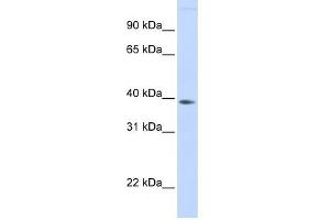 FAM76B antibody used at 1 ug/ml to detect target protein.