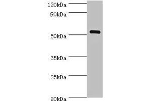 Western blot All lanes: MEF2C antibody at 1 μg/mL + Mouse skeletal muscle tissue Secondary Goat polyclonal to rabbit IgG at 1/10000 dilution Predicted band size: 52, 51, 48, 45, 53 kDa Observed band size: 52 kDa (MEF2C Antikörper  (AA 170-380))