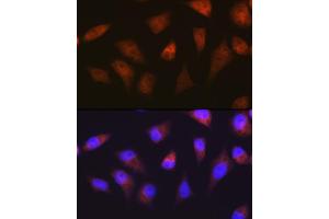 Immunofluorescence analysis of HeLa cells using PSM Rabbit mAb (ABIN7269597) at dilution of 1:100 (40x lens). (PSMA2 Antikörper)