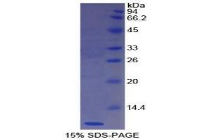 SDS-PAGE analysis of Human Nesfatin 1 Protein. (NUCB2 Protein)
