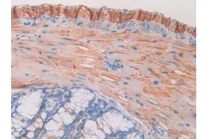 Detection of MAOA in Mouse Colon Tissue using Polyclonal Antibody to Monoamine Oxidase A (MAOA) (Monoamine Oxidase A Antikörper  (AA 229-428))
