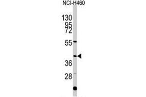 Western blot analysis of EN1 polyclonal antibody  in NCI-H460 cell line lysates (35 ug/lane). (EN1 Antikörper  (N-Term))