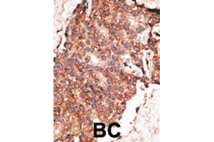 Immunohistochemistry (IHC) image for anti-Bone Morphogenetic Protein 1 (BMP1) antibody (ABIN2999234)