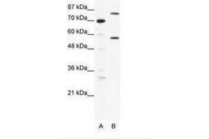 Image no. 1 for anti-Myoneurin (MYNN) (AA 371-420) antibody (ABIN202811) (Myoneurin Antikörper  (AA 371-420))