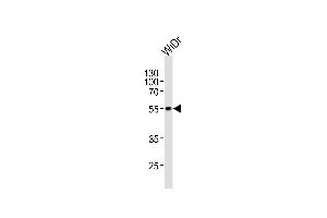 Western blot analysis of lysate from WiDr cell line, using hPDX1 (ABIN388773 and ABIN2839108). (PDX1 Antikörper  (C-Term))