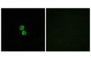 Immunofluorescence analysis of MCF-7 cells, using CKLF1 antibody. (CMTM1 Antikörper)