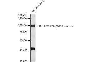 Western blot analysis of extracts of Mouse uterus, using TGF beta Receptor II (TGF beta Receptor II (TGFBR2)) antibody (ABIN6130735, ABIN6149085, ABIN6149088 and ABIN6215477) at 1:1000 dilution. (TGFBR2 Antikörper  (AA 23-280))