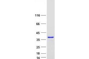Western Blotting (WB) image for Heterogeneous Nuclear Ribonucleoprotein A2/B1 (HNRNPA2B1) protein (Myc-DYKDDDDK Tag) (ABIN2722908)