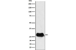 Western blot analysis of HLA DMB expression in Raji cell lysate.