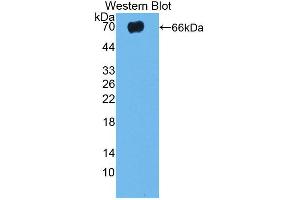 Western blot analysis of the recombinant protein. (TLR5 Antikörper  (AA 325-644))