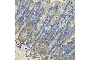 Immunohistochemistry of paraffin-embedded mouse intestine using NAA50 Antibody (ABIN5975518) at dilution of 1/100 (40x lens). (NAA50 Antikörper)