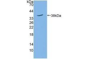 Detection of Recombinant SIRT6, Mouse using Polyclonal Antibody to Sirtuin 6 (SIRT6) (SIRT6 Antikörper  (AA 1-334))