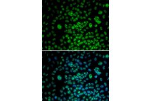 Immunofluorescence analysis of U20S cell using MAX antibody. (MAX Antikörper  (AA 1-160))