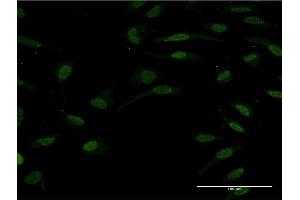 Immunofluorescence of monoclonal antibody to HNF1B on HeLa cell.