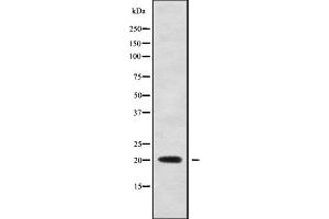 Western blot analysis of TNFRSF17 using Jurkat whole cell lysates (BCMA Antikörper  (Internal Region))