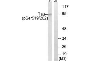 Western blot analysis of extracts from Jurkat cells, treated with H2O2 (100uM, 30mins), using Tau (Phospho-Ser519/202) antibody.