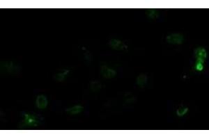 Anti-LGR5 mouse monoclonal antibody (ABIN2454609) immunofluorescent staining of COS7 cells transiently transfected by pCMV6-ENTRY LGR5 (RC212825). (LGR5 Antikörper  (AA 250-550))