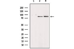 Western blot analysis of extracts from various samples, using HGF Antibody. (HGF Antikörper  (Internal Region))